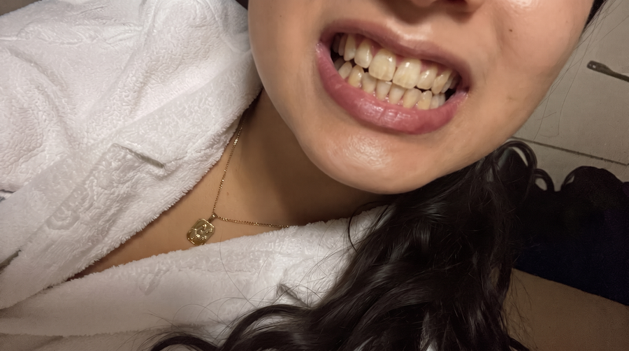 Antes