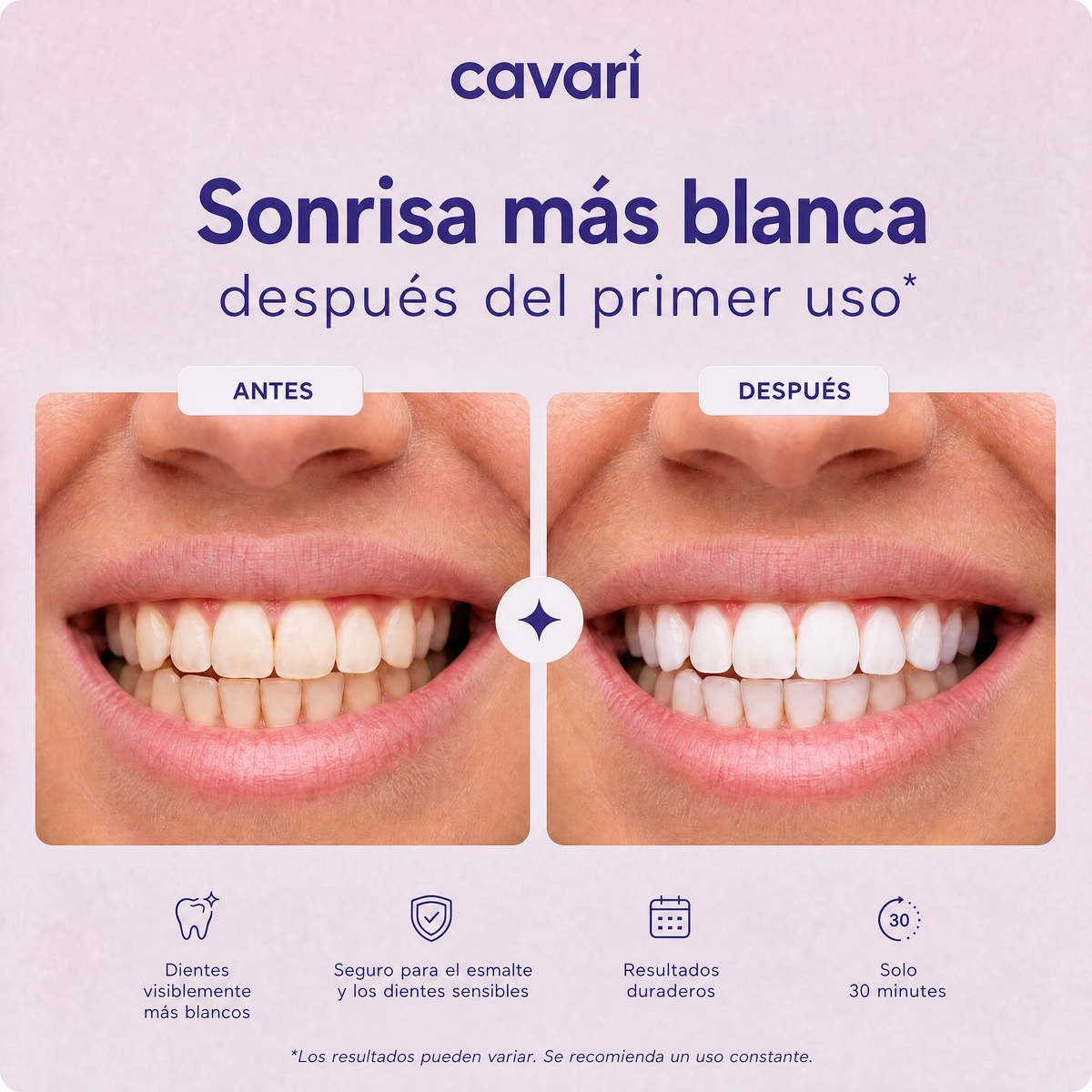 Cavari™  Tiras Blanqueadoras