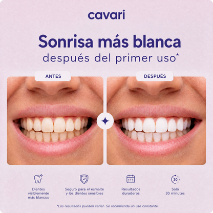 Cavari™  Tiras Blanqueadoras