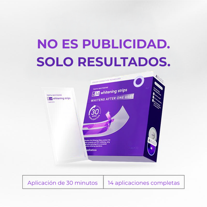 Cavari™ V34 Bandas Blanqueadoras – Blanqueamiento de Color Dental